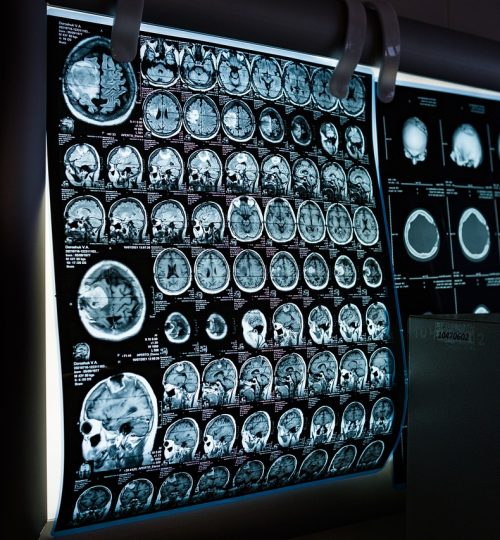 x-ray, mri, ct scan-6841384.jpg